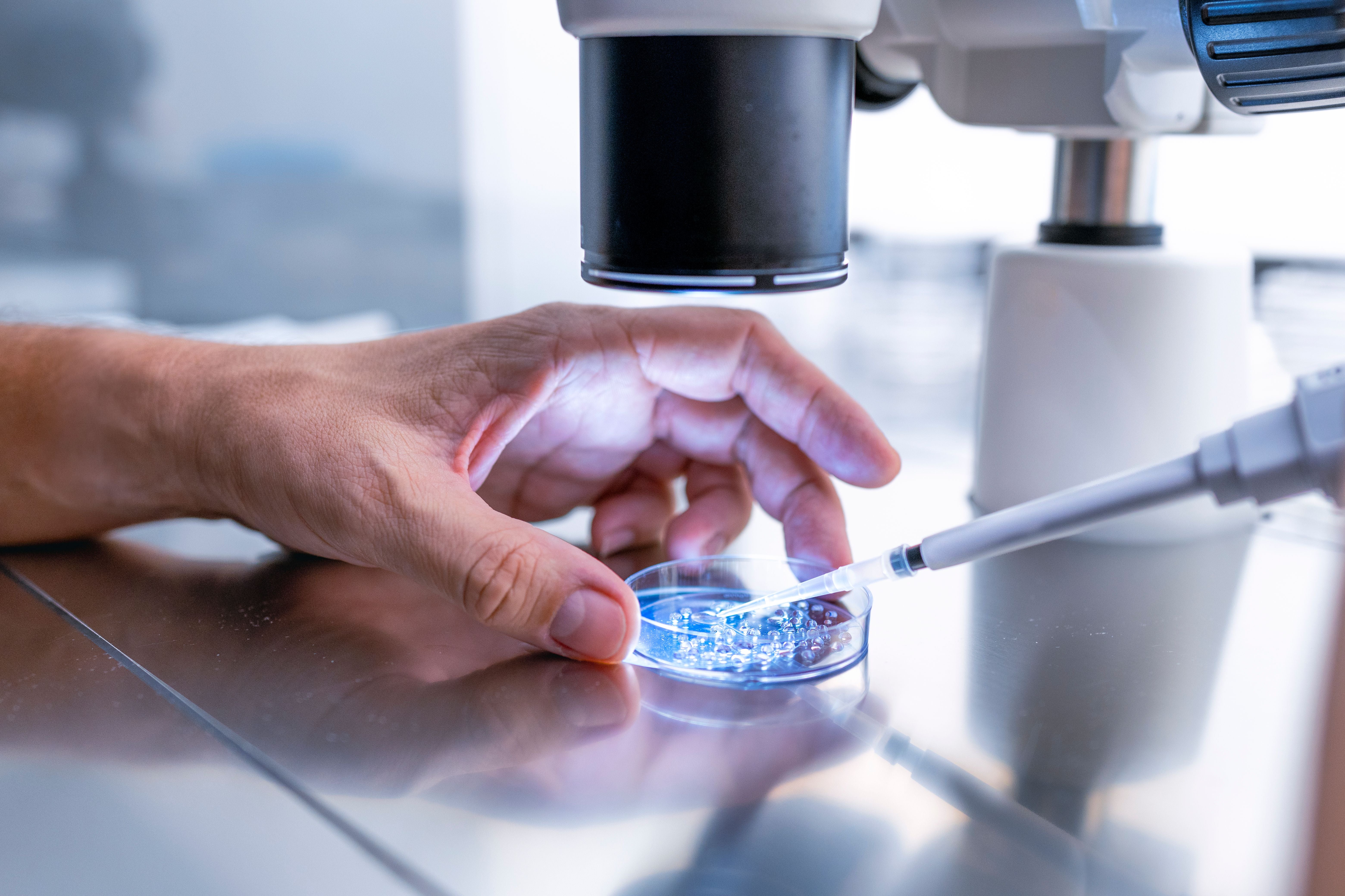Hand hält Petrischale unter Mikroskop, während Pipette Flüssigkeit für Embryokultivierung hinzufügt.