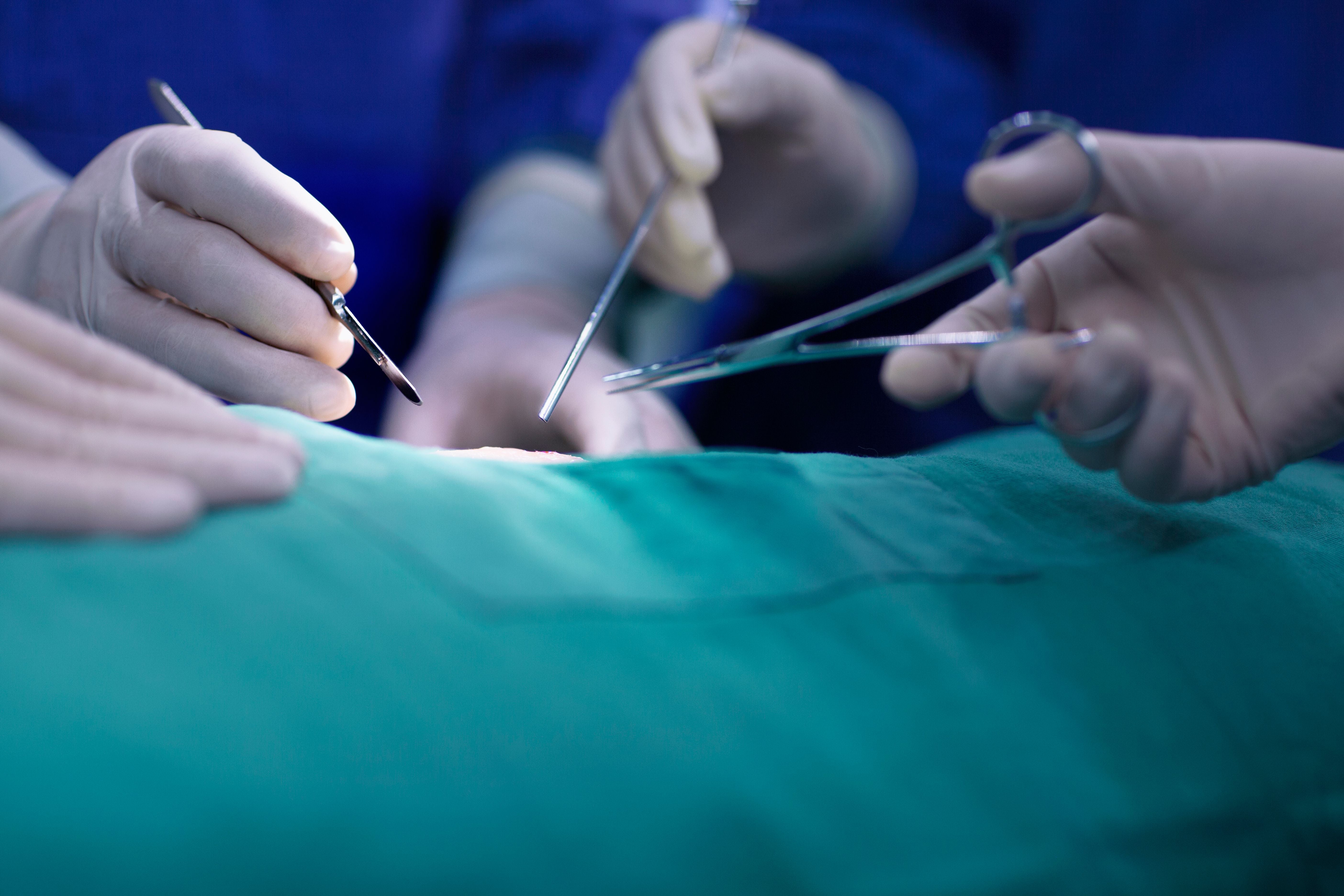 Chirurgen führen mit Instrumenten eine Operation an einem Patienten durch.