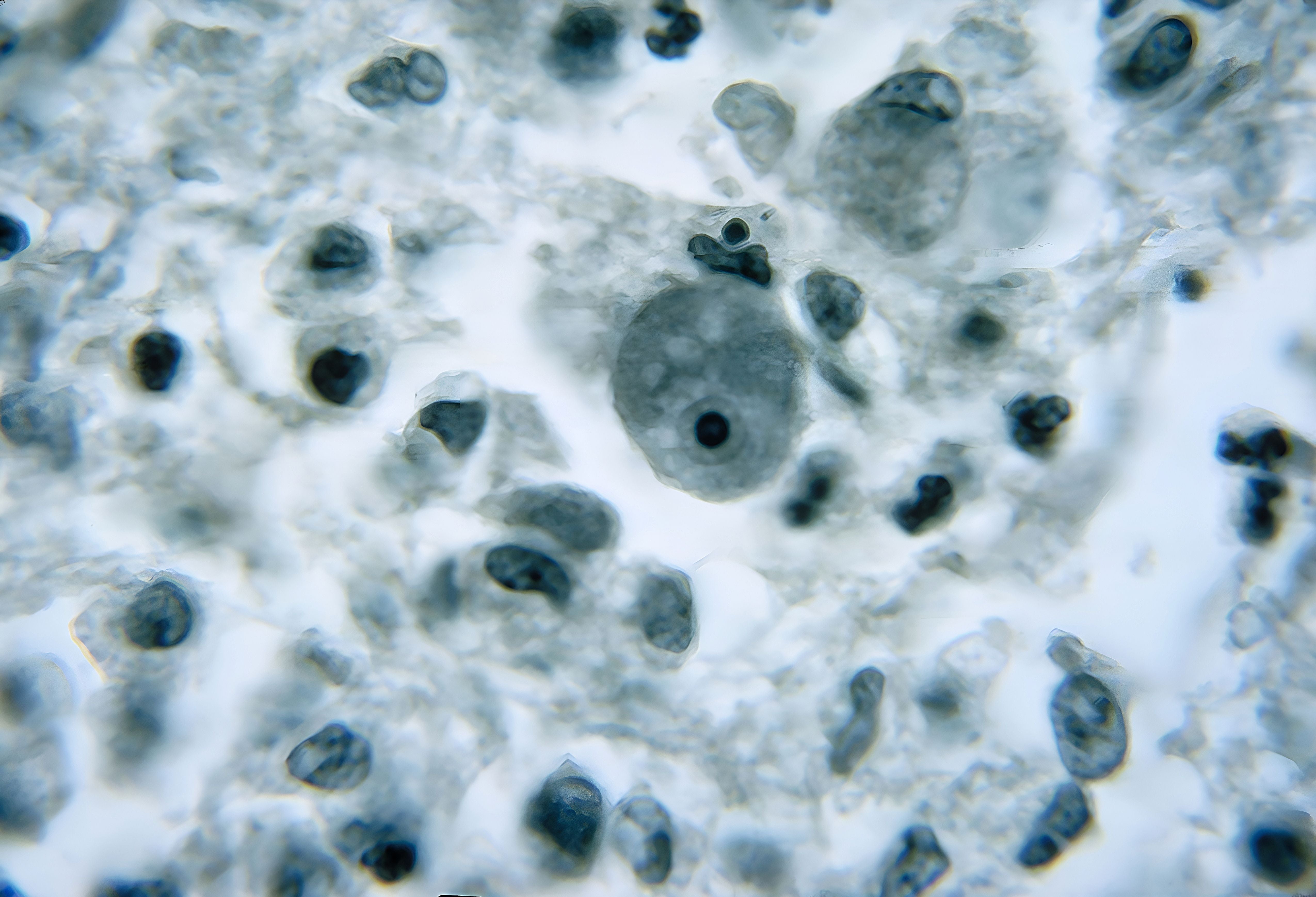 Naegleria fowleri