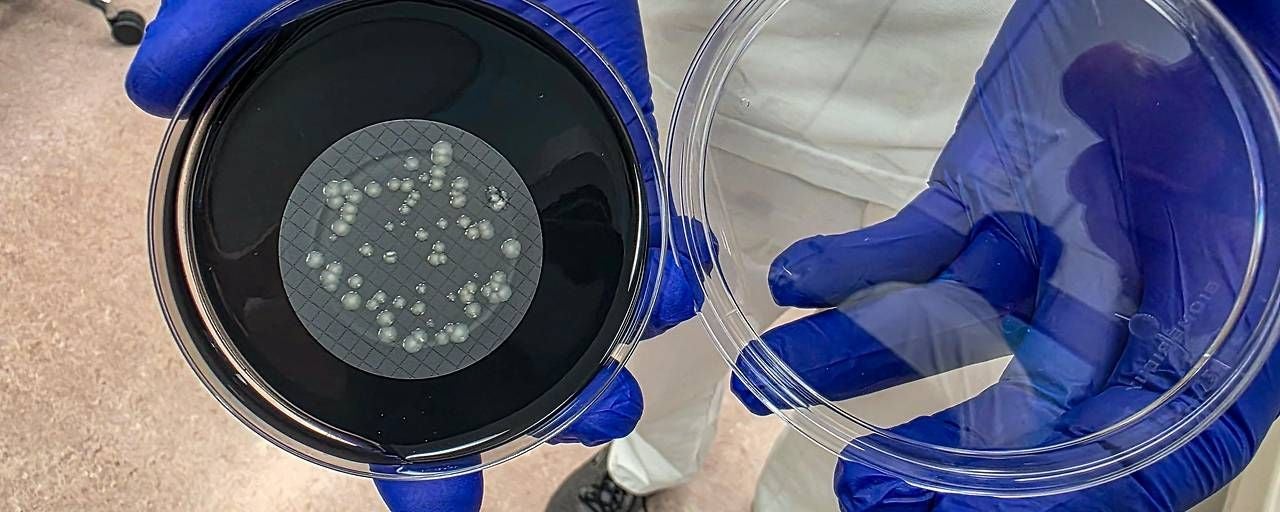 Hands mit blauen Handschuhen halten eine Petrischale mit Bakterienkolonien auf Nährboden.