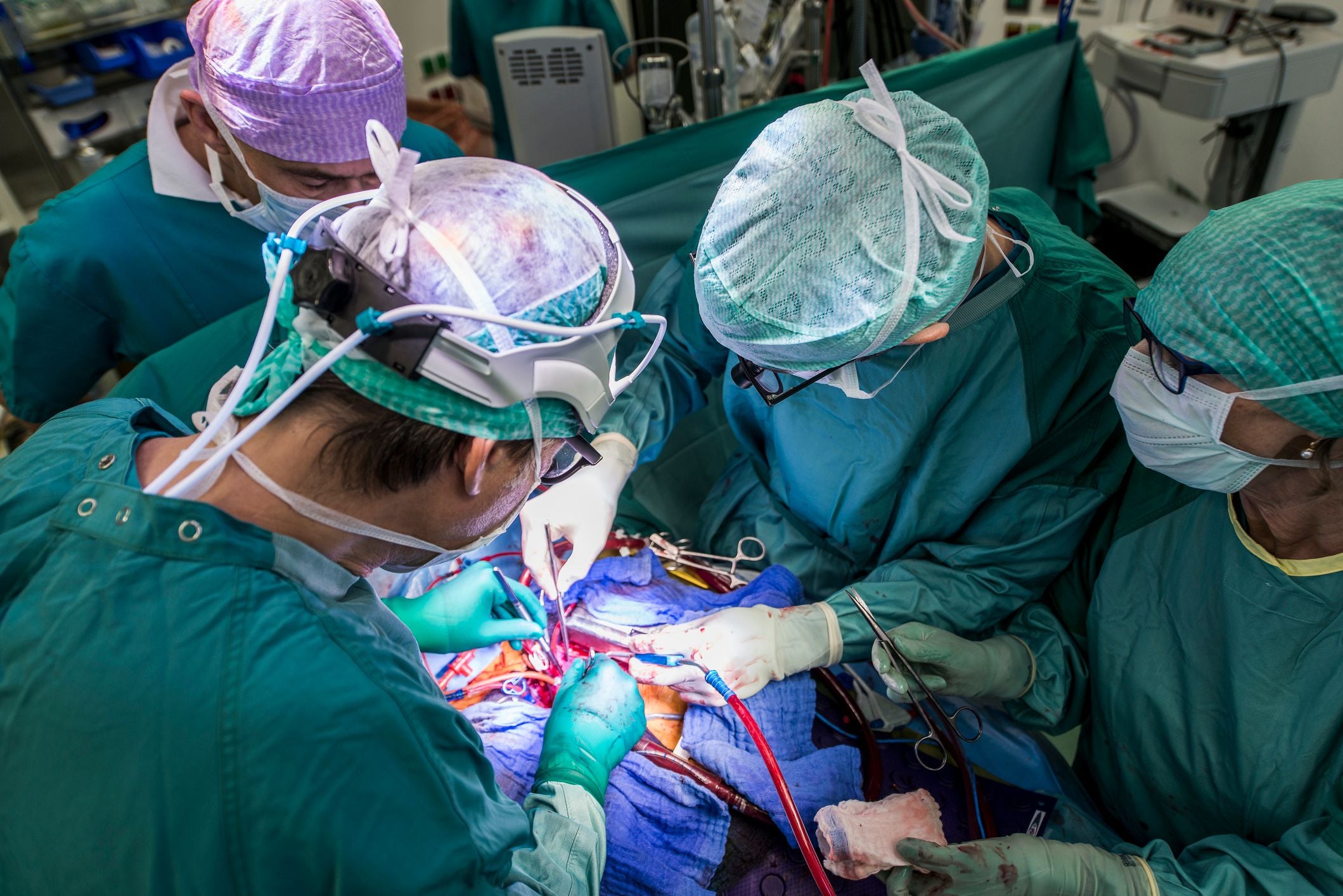Ein Ärzteteam führt eine Herzoperation im Operationssaal durch.