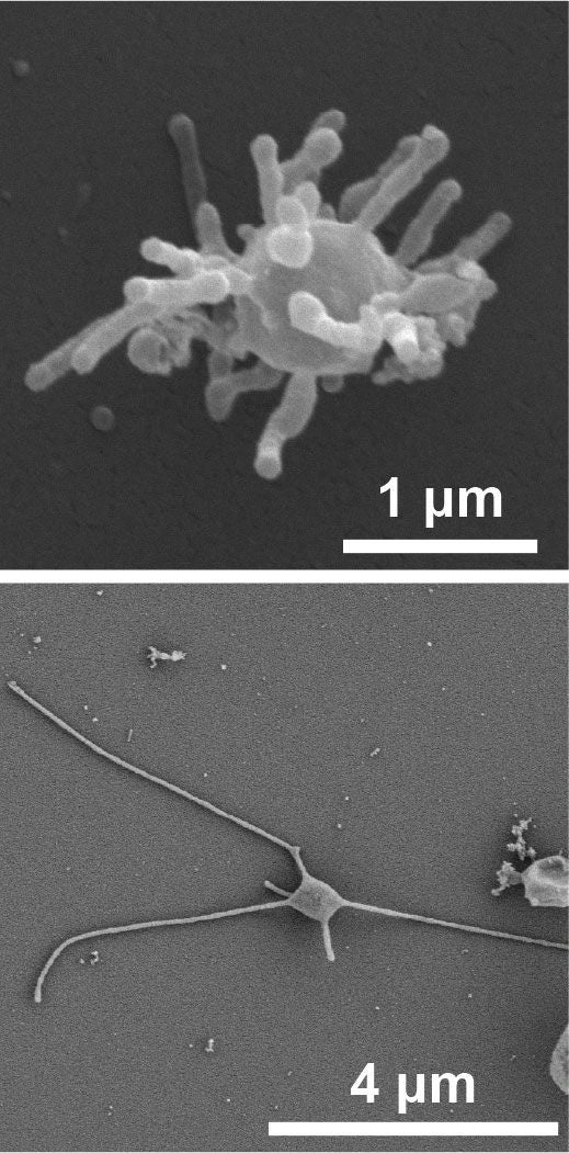 Zwei elektronenmikroskopische Aufnahmen von Asgard-Archaeen mit fadenartigen Fortsätzen.